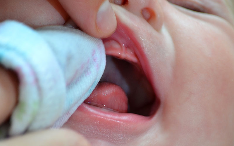 Facts about teeth