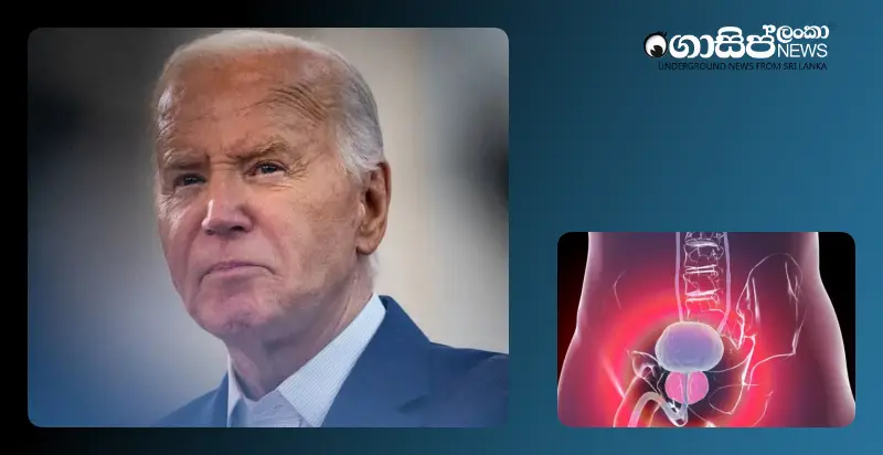 former-president-joe-biden-has-prostate-cancer former-president-joe-biden-has-prostate-cancer