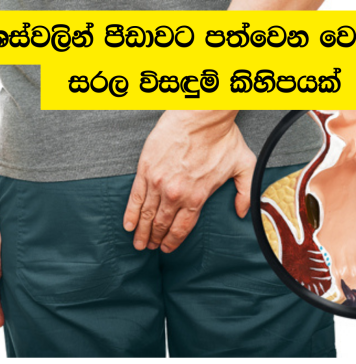ඔබට අර්ශස් ඇති විට ජීවන රටාව වෙනස් කරගන්නේ කෙසේද?