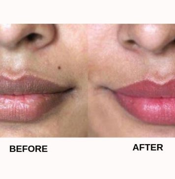 රස්නේ කාලෙට වියළීමට ලක් වෙන දෙතොල් වලට විශේෂිත ප්රතිකාරයක්