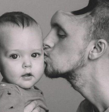 හිස්කබලෙන් කොටසක් අහිමි වූ සැමියා අත් නොහැර ළඟ සිටි බිරිඳක්