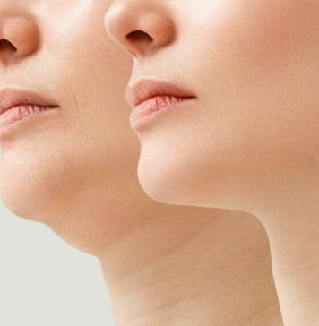 දින හතෙන් ඩබල් චින් අඩු කරන හරිම ක්රමය මෙන්න..