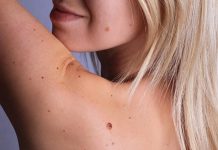 අපේ ලස්සනට බාධාවක් වෙන ඉන්නන් ඉවත් කරන ක්රම