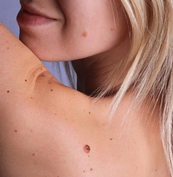 අපේ ලස්සනට බාධාවක් වෙන ඉන්නන් ඉවත් කරන ක්රම