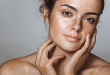 පිග්මන්ටේශන් තත්වයකට නිවසේදීම කළහැකි ප්රතිකාර