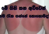 අධික රස්නය සහිත කාලයක දී සම සුරකිමු
