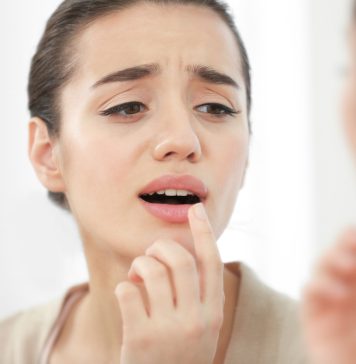 මුඛයේ ඇතිවෙන ඌෂ්ණ බිබිළි වලට නිවසේදීම කලහැකි ප්රතිකාර