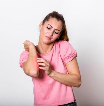 ලොකු පොඩි කාටත් මාරාන්තික විය හැකි ආසාත්මිකතා (Allergy) ගැන ඔබත් සැලකිලිමත් ද?