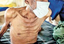 යළි හිස ඔසවන ‘ක්ෂය රෝගය’