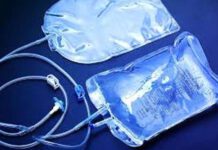 වකුගඩු රෝගීන් සඳහා ඩයලිසිස් ද්රාවණ බෑග් 800,000ක් මිලදී ගැනීමට රජයේ අනුමැතිය!